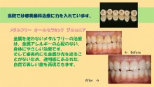 集患.com  看板・販促広告など複合的なマーケティング戦略で歯科医院の集患をお手伝いします。-b18